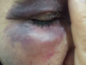 Şanlıurfa’da Miras Kavgası: 4 Kişi Yaralandı